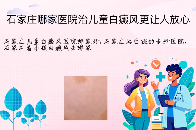 石家庄哪家医院治儿童白癜风更让人放心