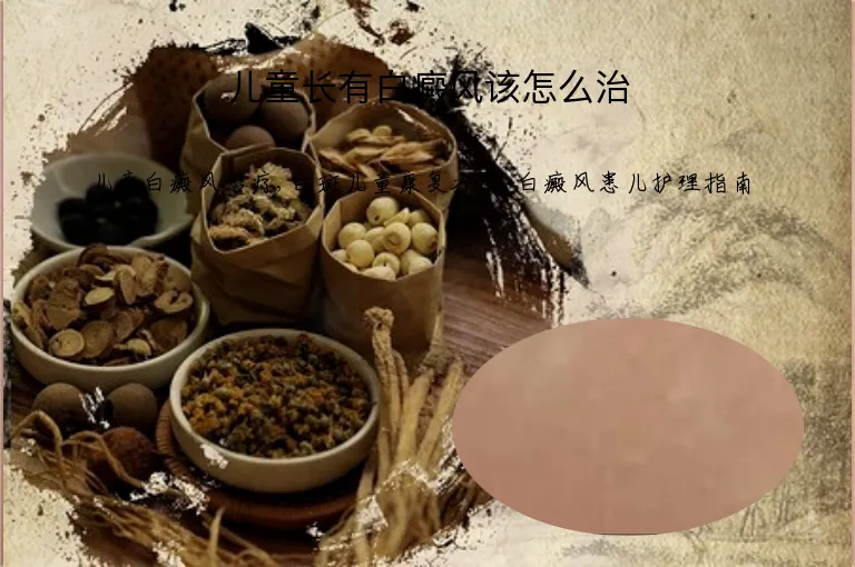 儿童长有白癜风该怎么治