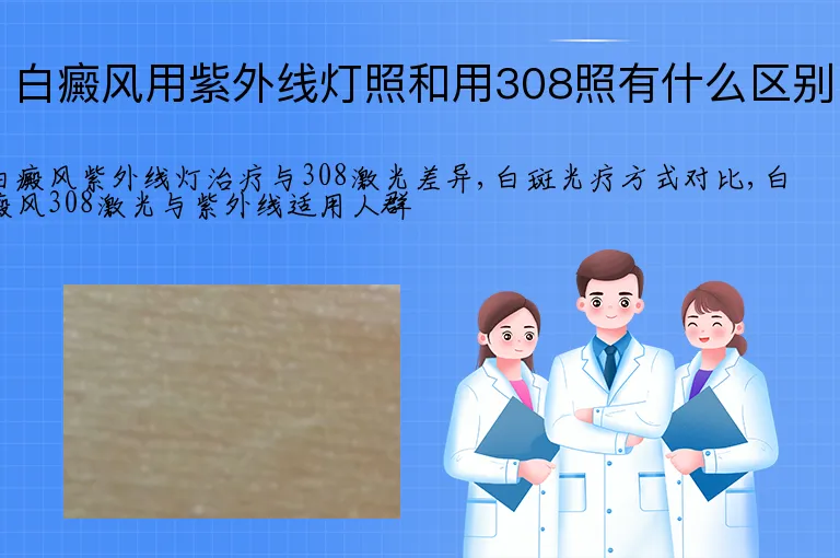 白癜风用紫外线灯照和用308照有什么区别