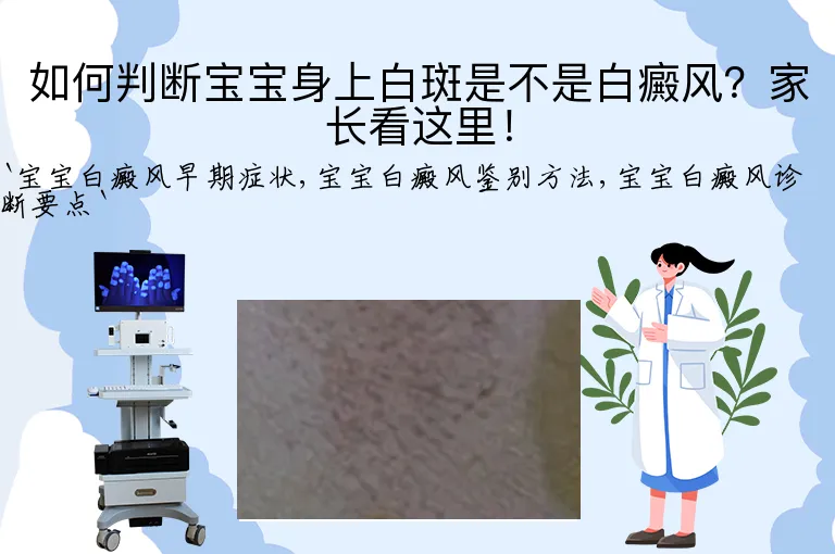 如何判断宝宝身上白斑是不是白癜风？家长看这里！