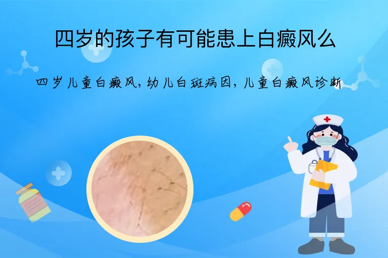 四岁的孩子有可能患上白癜风么