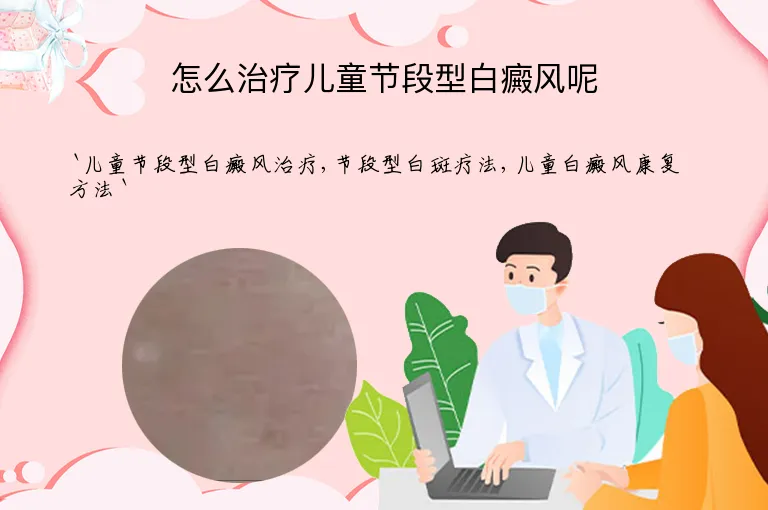 怎么治疗儿童节段型白癜风呢