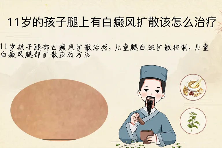 11岁的孩子腿上有白癜风扩散该怎么治疗