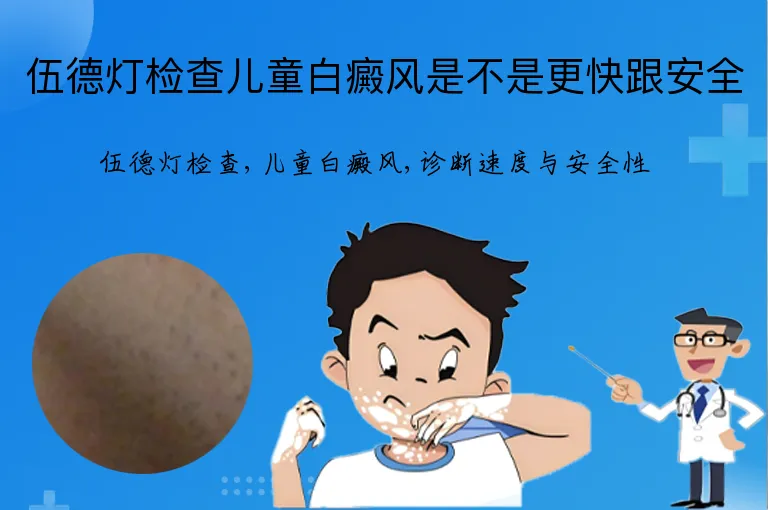 伍德灯检查儿童白癜风是不是更快跟安全