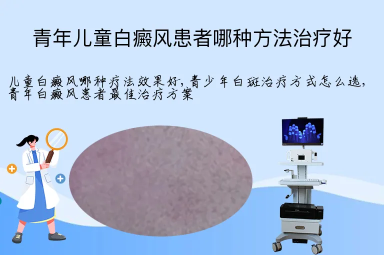 青年儿童白癜风患者哪种方法治疗好