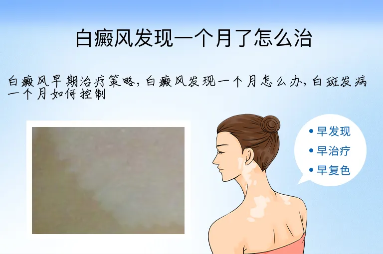 白癜风发现一个月了怎么治