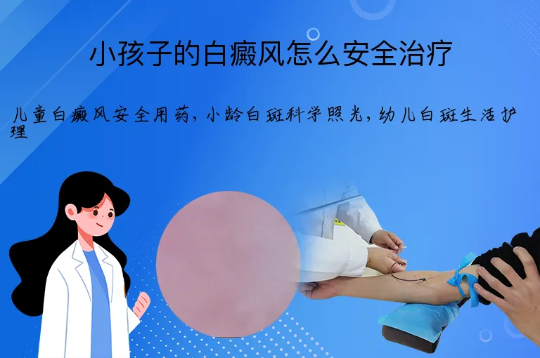 小孩子的白癜风怎么安全治疗
