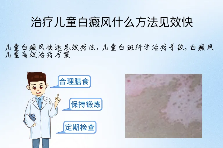治疗儿童白癜风什么方法见效快
