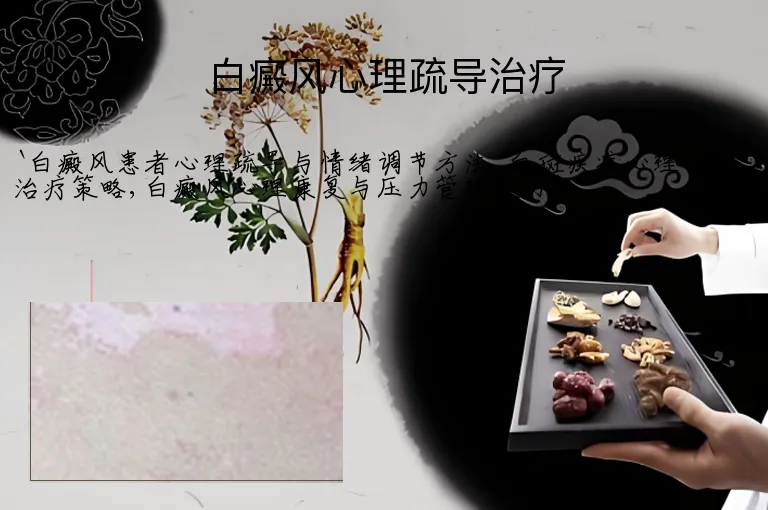白癜风心理疏导治疗