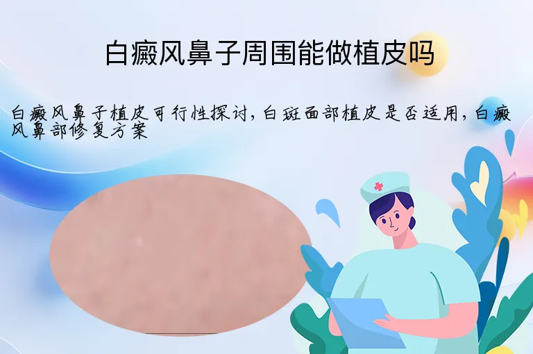 白癜风鼻子周围能做植皮吗