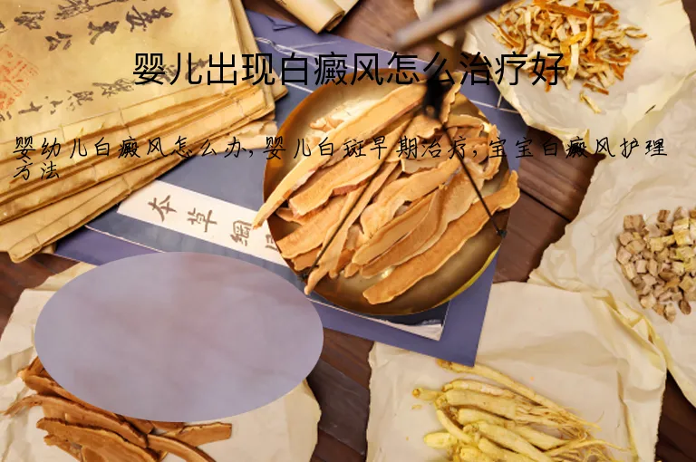 婴儿出现白癜风怎么治疗好