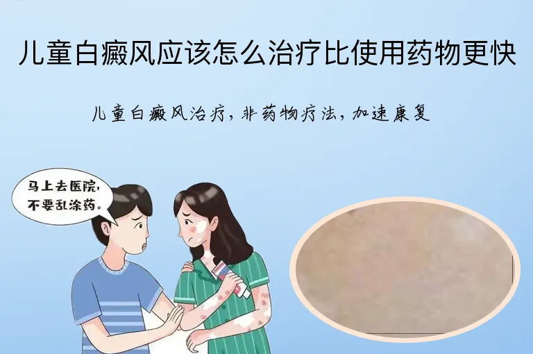 儿童白癜风应该怎么治疗比使用药物更快