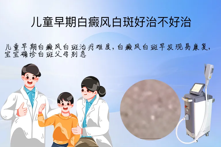 儿童早期白癜风白斑好治不好治
