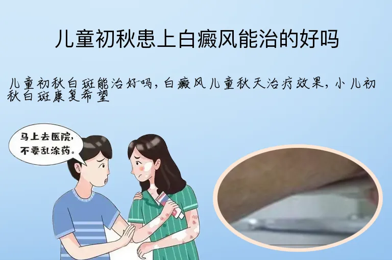 儿童初秋患上白癜风能治的好吗