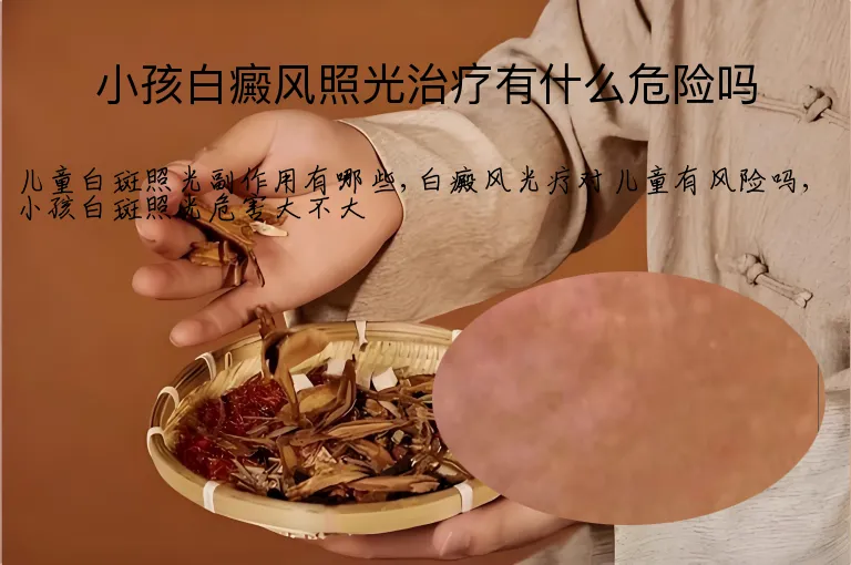 小孩白癜风照光治疗有什么危险吗