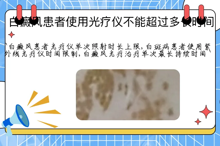 白癜风患者使用光疗仪不能超过多长时间