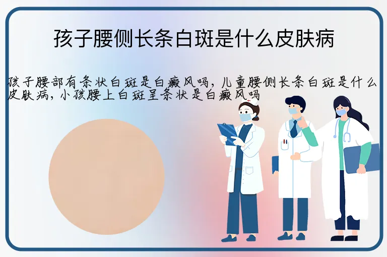 孩子腰侧长条白斑是什么皮肤病