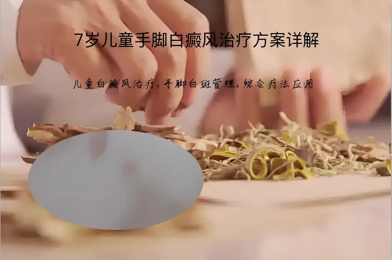 7岁儿童手脚白癜风治疗方案详解