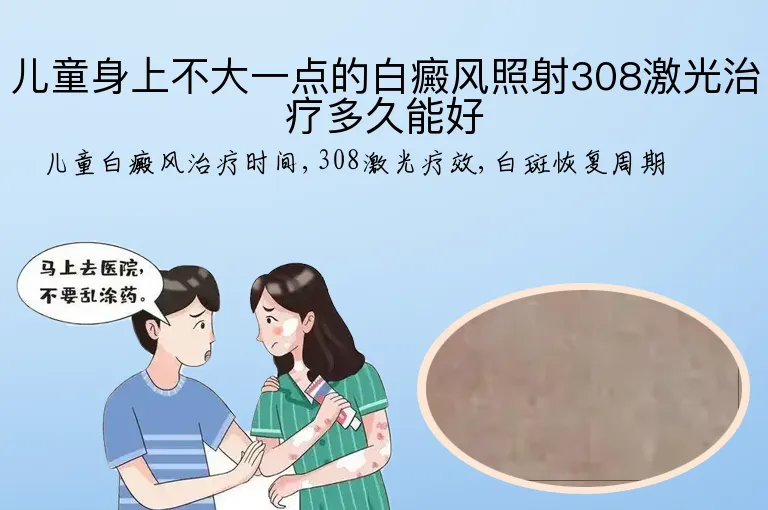 儿童身上不大一点的白癜风照射308激光治疗多久能好