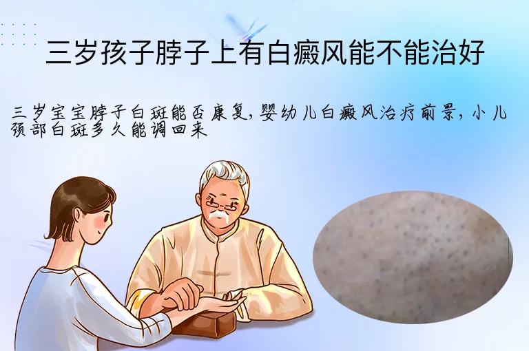 三岁孩子脖子上有白癜风能不能治好