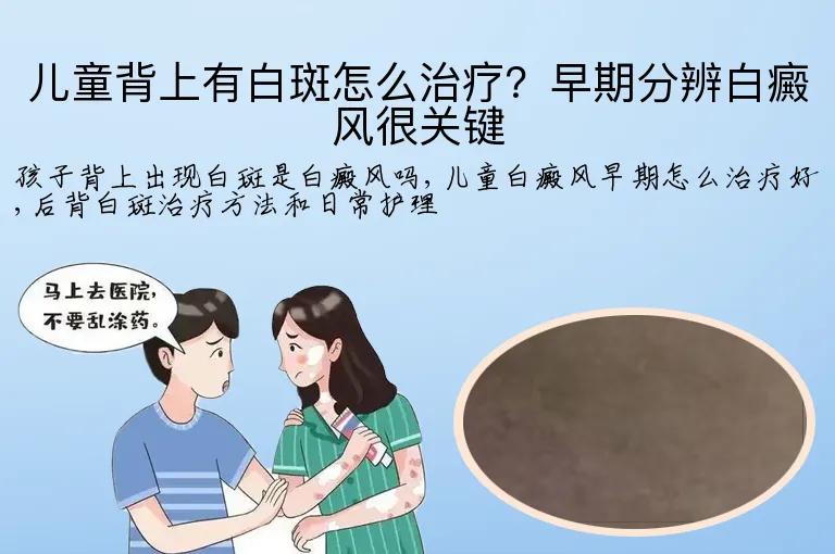 儿童背上有白斑怎么治疗?早期分辨白癜风很关键