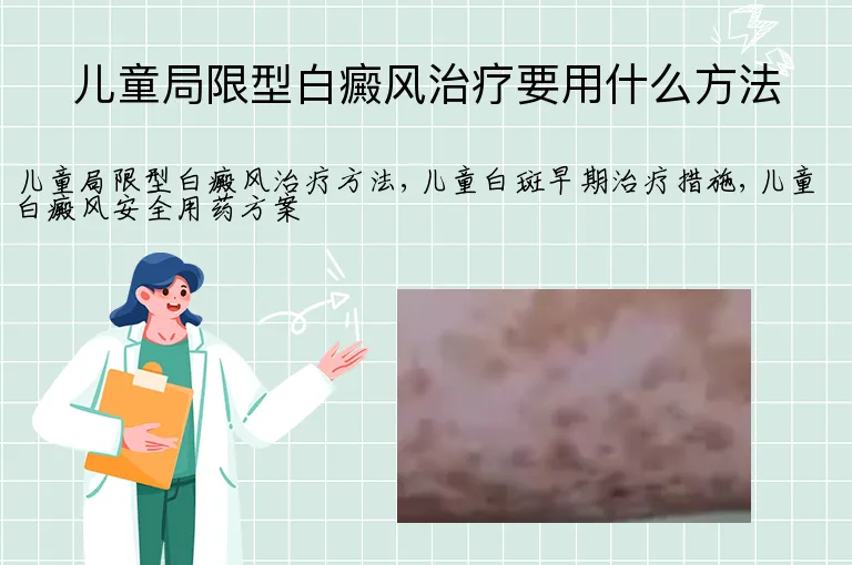 儿童局限型白癜风治疗要用什么方法