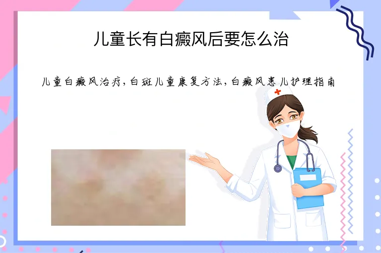 儿童长有白癜风后要怎么治
