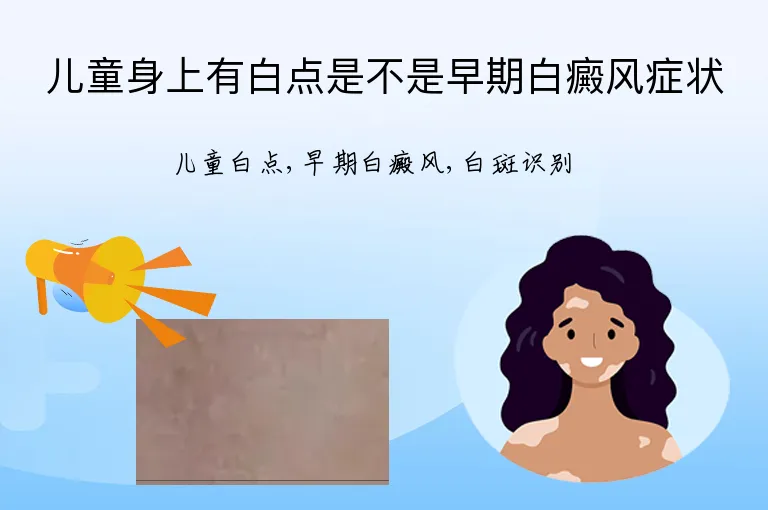 儿童身上有白点是不是早期白癜风症状