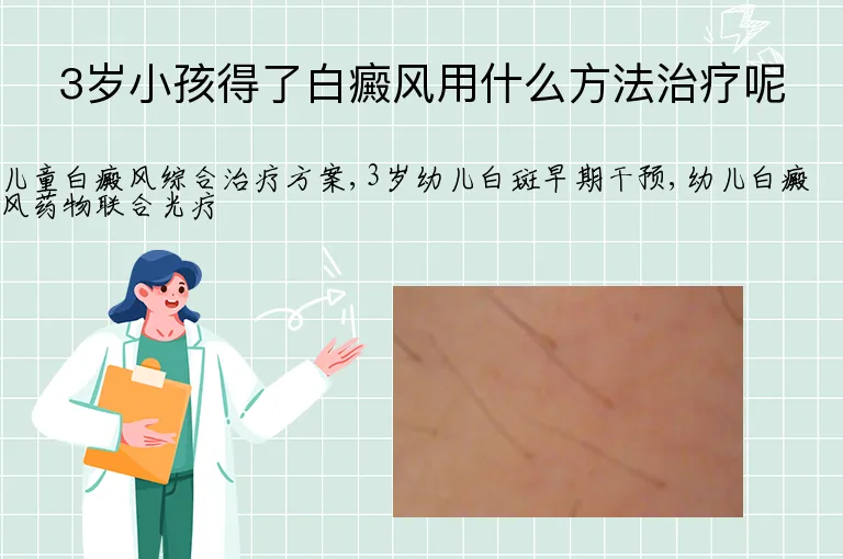 3岁小孩得了白癜风用什么方法治疗呢