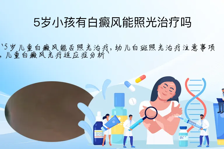 5岁小孩有白癜风能照光治疗吗