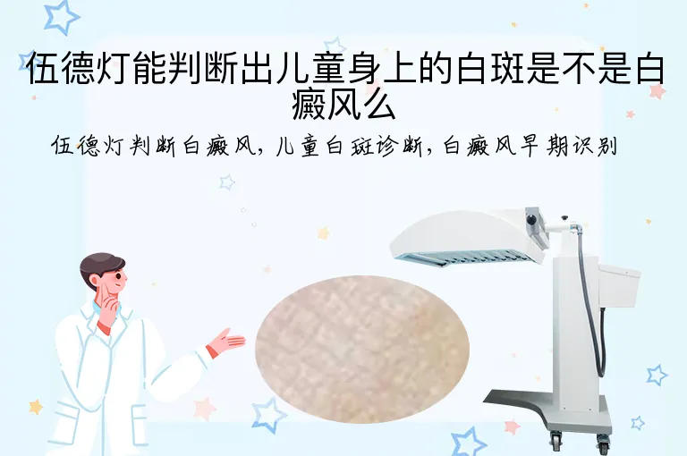 伍德灯能判断出儿童身上的白斑是不是白癜风么