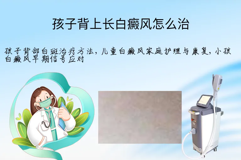 孩子背上长白癜风怎么治
