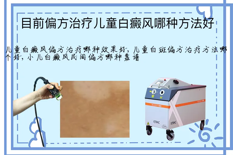 目前偏方治疗儿童白癜风哪种方法好