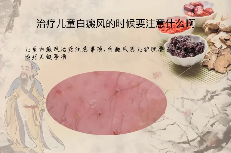 治疗儿童白癜风的时候要注意什么啊