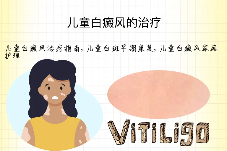 儿童白癜风的治疗