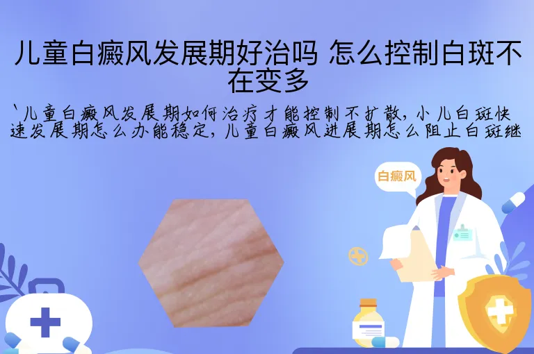 儿童白癜风发展期好治吗 怎么控制白斑不在变多