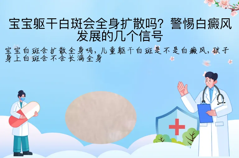 宝宝躯干白斑会全身扩散吗？警惕白癜风发展的几个信号