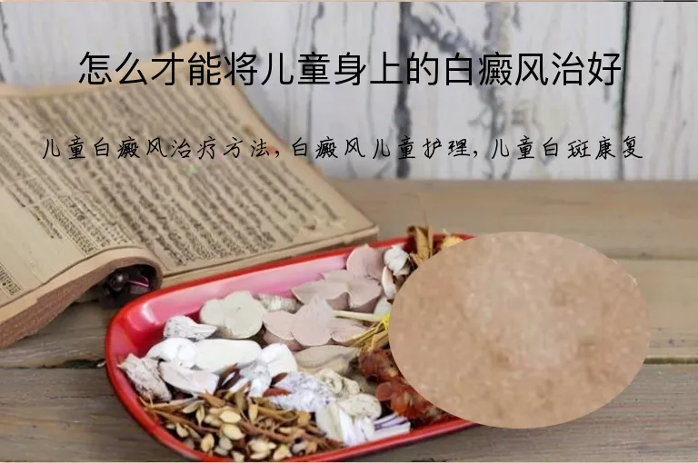 怎么才能将儿童身上的白癜风治好