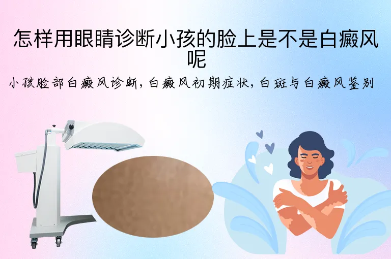 怎样用眼睛诊断小孩的脸上是不是白癜风呢