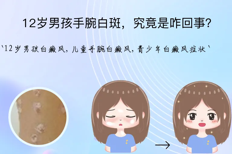 12岁男孩手腕白斑，究竟是咋回事？