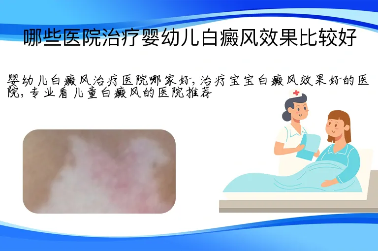 哪些医院治疗婴幼儿白癜风效果比较好