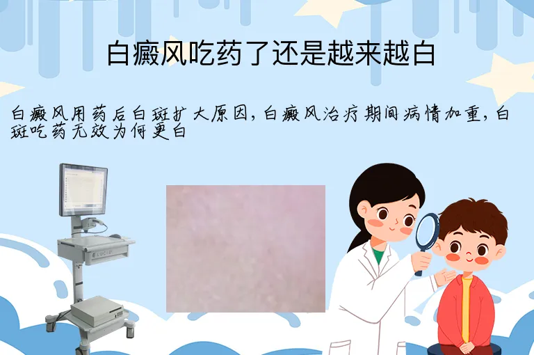 白癜风吃药了还是越来越白