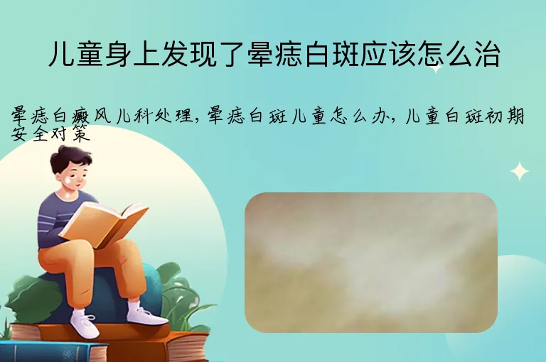 儿童身上发现了晕痣白斑应该怎么治