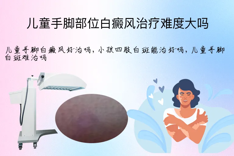 儿童手脚部位白癜风治疗难度大吗