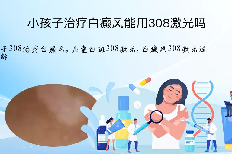 小孩子治疗白癜风能用308激光吗
