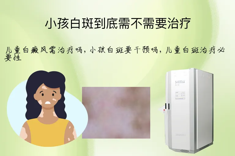 小孩白斑到底需不需要治疗