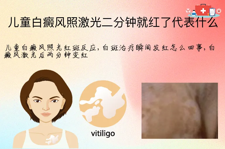 儿童白癜风照激光二分钟就红了代表什么