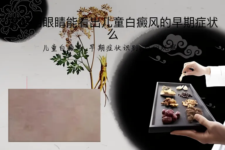 家长用眼睛能看出儿童白癜风的早期症状么