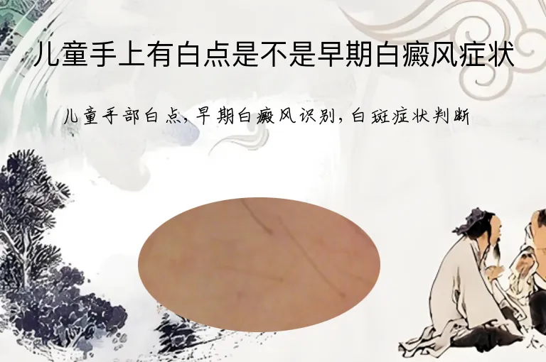 儿童手上有白点是不是早期白癜风症状