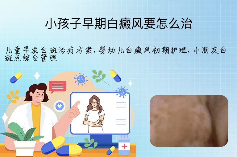 小孩子早期白癜风要怎么治